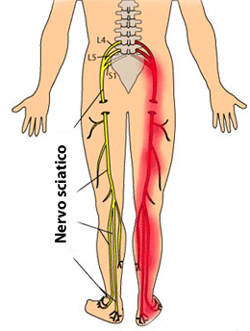 dolore gamga gluteo piede